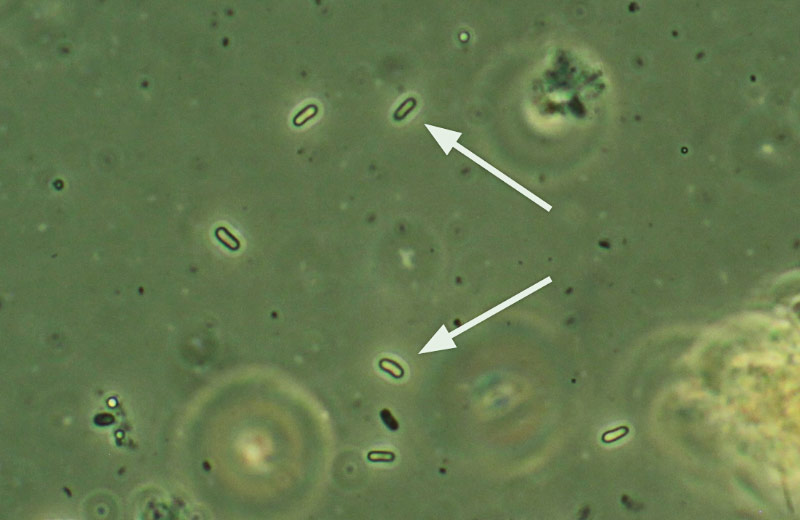Microsporidia under magnification.
